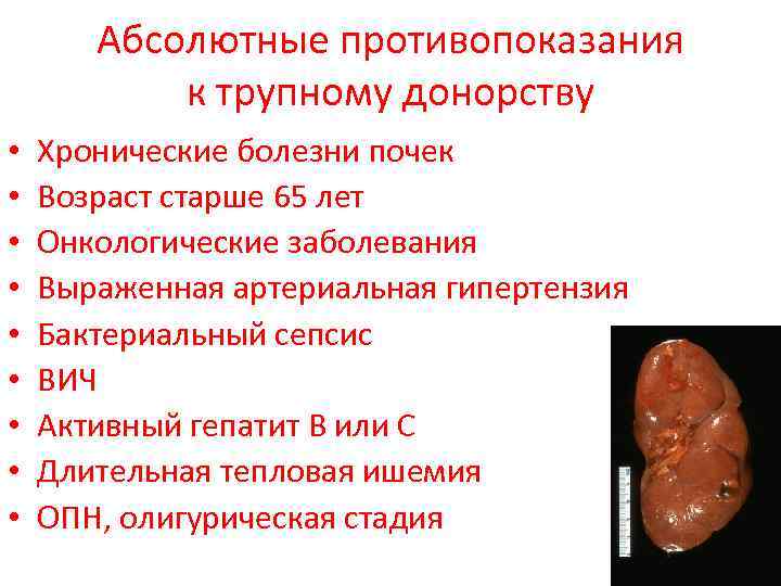 Абсолютные противопоказания к трупному донорству • • • Хронические болезни почек Возраст старше 65