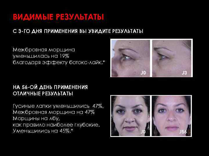ВИДИМЫЕ РЕЗУЛЬТАТЫ С 3 -ГО ДНЯ ПРИМЕНЕНИЯ ВЫ УВИДИТЕ РЕЗУЛЬТАТЫ Межбровная морщина уменьшилась на