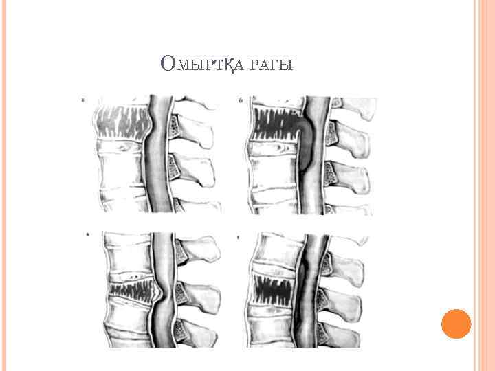 ОМЫРТҚА РАГЫ 