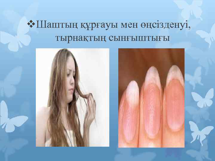 v. Шаштың құрғауы мен өңсізденуі, тырнақтың сынғыштығы 