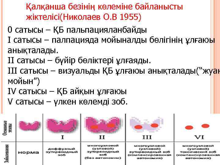 Қалқанша безінің көлеміне байланысты жіктелісі(Николаев О. В 1955) 0 сатысы – ҚБ пальпацияланбайды І