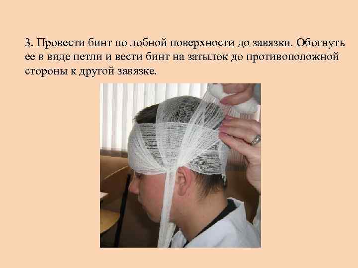 3. Провести бинт по лобной поверхности до завязки. Обогнуть ее в виде петли и