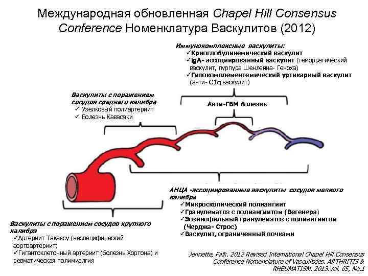 Международная обновленная Chapel Hill Consensus Conference Номенклатура Васкулитов (2012) Иммунокомплексные васкулиты: üКриоглобулинемический васкулит üIg.