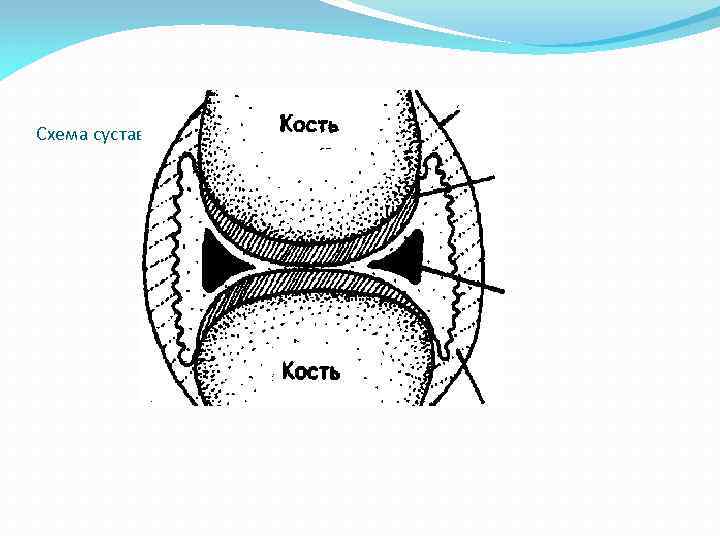 Схема сустава 