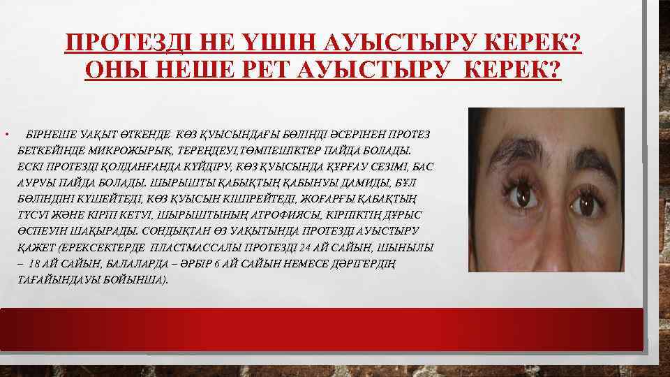 ПРОТЕЗДІ НЕ ҮШІН АУЫСТЫРУ КЕРЕК? ОНЫ НЕШЕ РЕТ АУЫСТЫРУ КЕРЕК? • БІРНЕШЕ УАҚЫТ ӨТКЕНДЕ