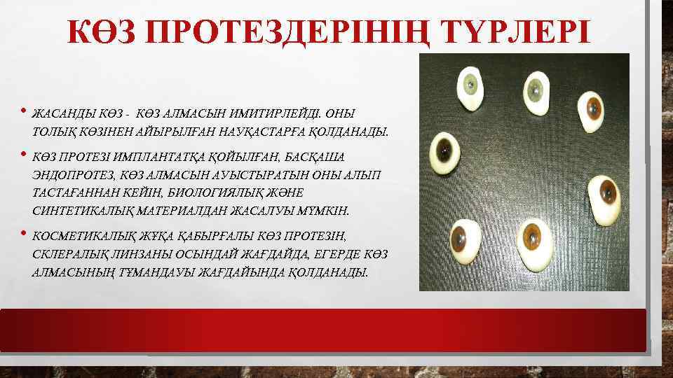  КӨЗ ПРОТЕЗДЕРІНІҢ ТҮРЛЕРІ • ЖАСАНДЫ КӨЗ - КӨЗ АЛМАСЫН ИМИТИРЛЕЙДІ. ОНЫ ТОЛЫҚ КӨЗІНЕН