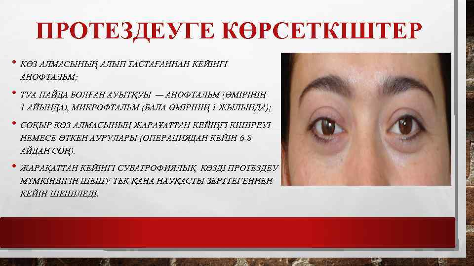 ПРОТЕЗДЕУГЕ КӨРСЕТКІШТЕР • КӨЗ АЛМАСЫНЫҢ АЛЫП ТАСТАҒАННАН КЕЙІНГІ АНОФТАЛЬМ; • ТУА ПАЙДА БОЛҒАН АУЫТҚУЫ