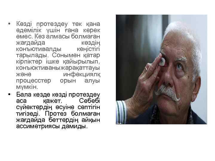  • Көзді протездеу тек қана әдемілік үшін ғана керек емес. Көз алмасы болмаған