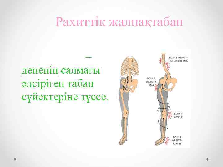 Рахиттік жалпақтабан – дененің салмағы әлсіріген табан сүйектеріне түссе. 