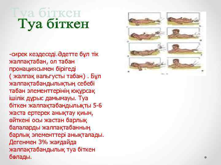 -сирек кездеседі. Әдетте бұл тік жалпақтабан, ол табан пронациясымен бірігеді ( жалпақ вальгусты табан).
