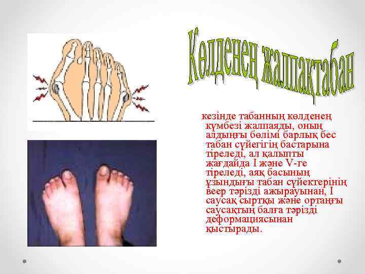 кезінде табанның көлденең күмбезі жалпаяды, оның алдыңғы бөлімі барлық бес табан сүйегігің бастарына тіреледі,