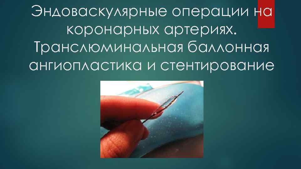 Эндоваскулярные операции на коронарных артериях. Транслюминальная баллонная ангиопластика и стентирование 