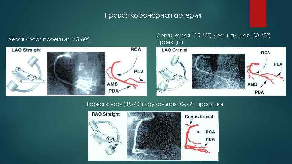 Презентация коронарные артерии