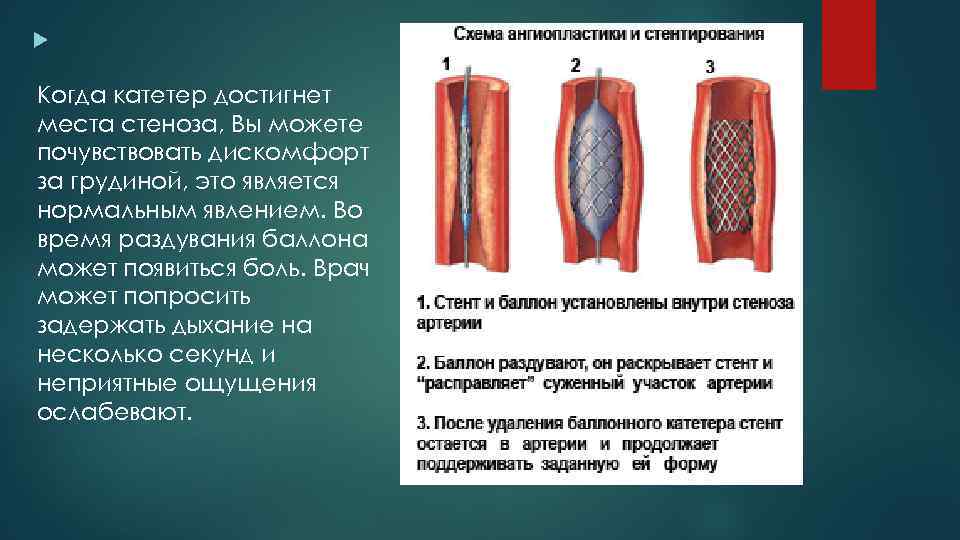 Транслюминальная хирургия презентация