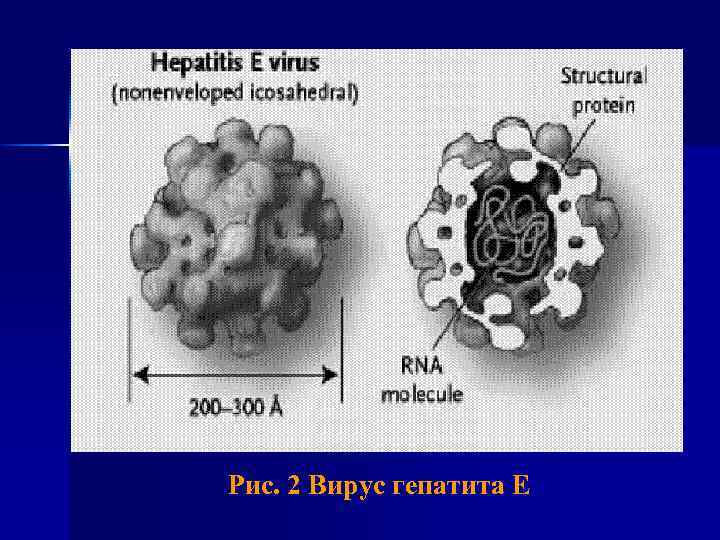 Рис. 2 Вирус гепатита E 