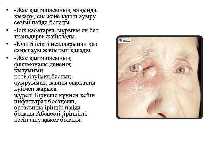  • -Жас қалташасының маңында қызару, ісік және күшті ауыру сезімі пайда болады. •