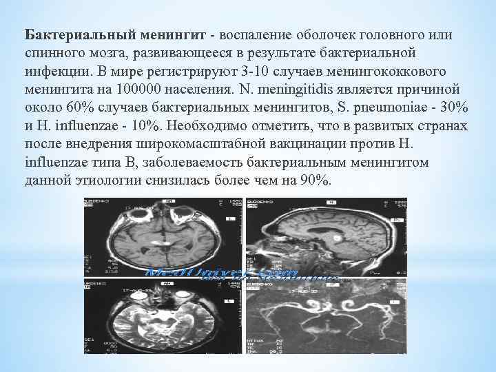 Воспаление оболочек