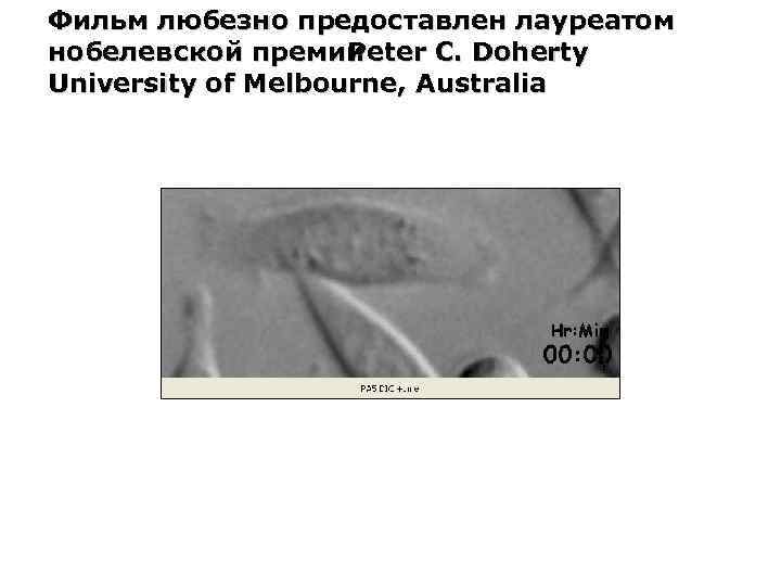 Фильм любезно предоставлен лауреатом нобелевской премии Peter C. Doherty University of Melbourne, Australia 