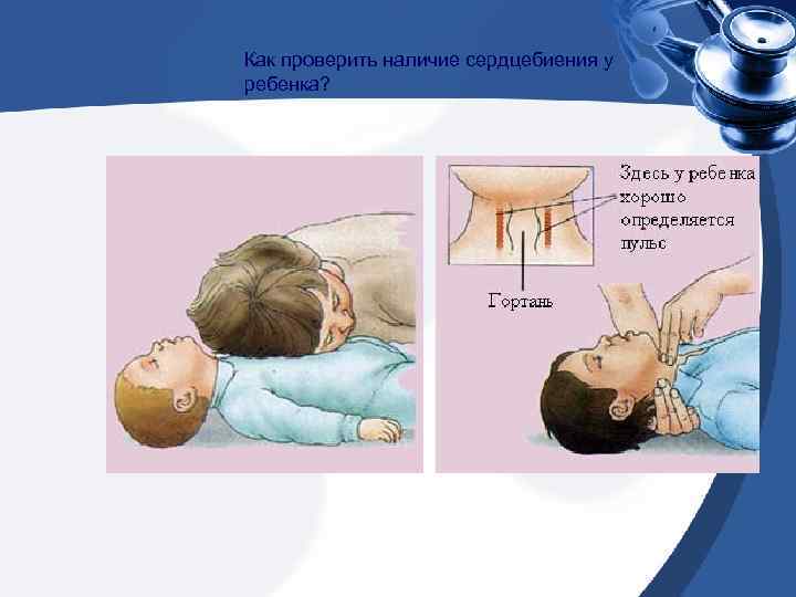 Как проверить наличие сердцебиения у ребенка? 