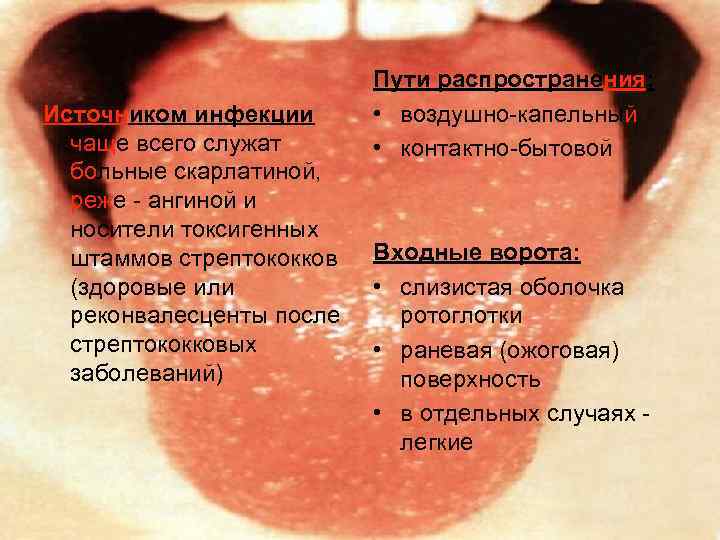 Источником инфекции чаще всего служат больные скарлатиной, реже - ангиной и носители токсигенных штаммов