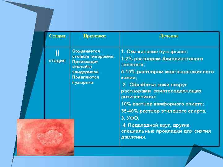 Стадия Признаки II Сохраняется стойкая гиперемия. Происходит отслойка эпидермиса. Появляются пузырьки. стадия Лечение 1.