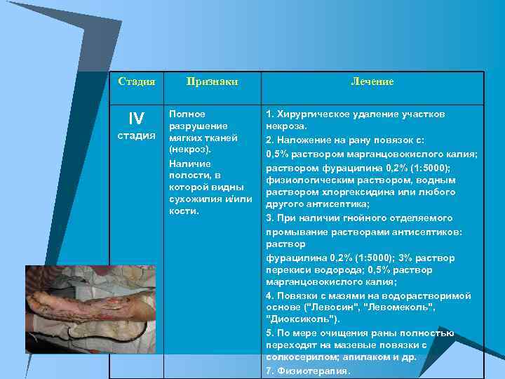 Стадия Признаки Лечение IV Полное разрушение мягких тканей (некроз). Наличие полости, в которой видны