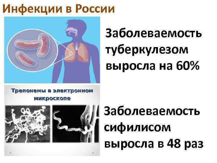 Инфекции в России Заболеваемость туберкулезом выросла на 60% Заболеваемость сифилисом выросла в 48 раз