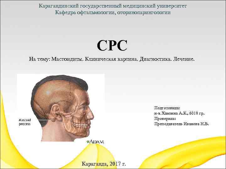 Карагандинский государственный медицинский университет Кафедра офтальмологии, оториноларингологии СРС На тему: Мастоидиты. Клиническая картина. Диагностика.