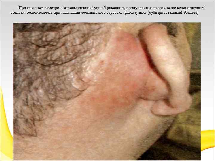  При внешнем осмотре - 