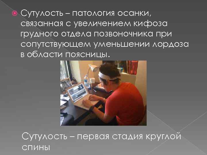  Сутулость – патология осанки, связанная с увеличением кифоза грудного отдела позвоночника при сопутствующем