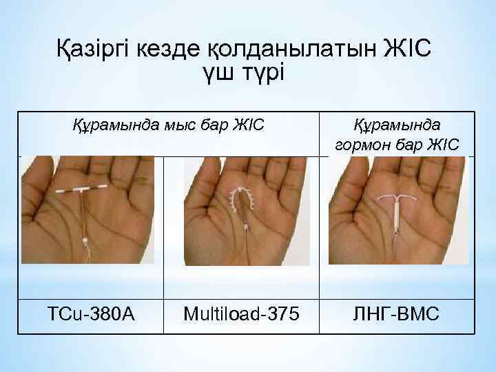 Қазіргі кезде қолданылатын ЖІС үш түрі Құрамында мыс бар ЖІС TCu-380 A Multiload-375 Құрамында