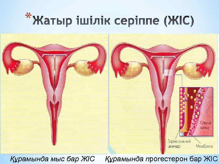 * Құрамында мыс бар ЖІС Құрамында прогестерон бар ЖІС 