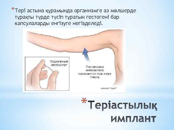 *Тері астына құрамында организмге аз мөлшерде тұрақты түрде түсіп тұратын гестогені бар капсулаларды енгізуге