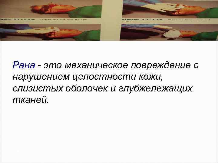 Раны Рана - это механическое повреждение с нарушением целостности кожи, слизистых оболочек и глубжележащих