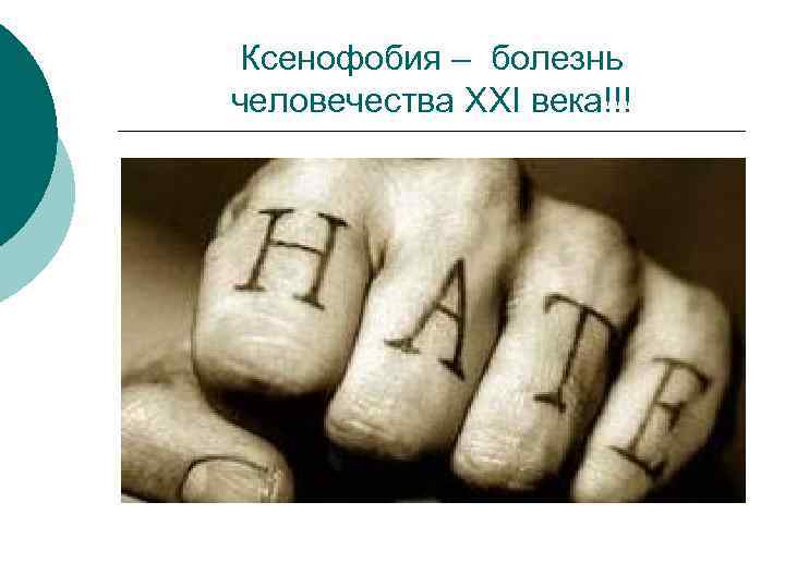 Ксенофобия – болезнь человечества XXI века!!! 