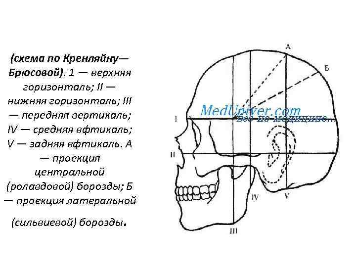 Схема кренлейна черепно мозговая