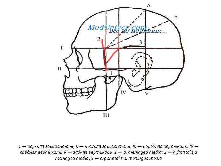 Проекция средней менингеальной артерии по схеме кренлейна брюсовой