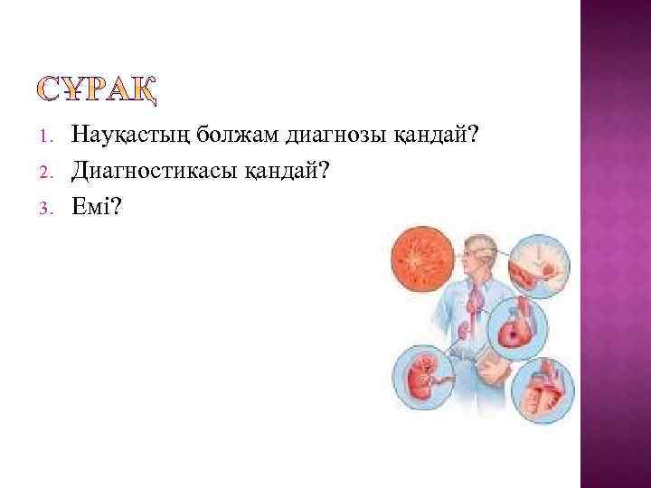 1. 2. 3. Науқастың болжам диагнозы қандай? Диагностикасы қандай? Емі? 