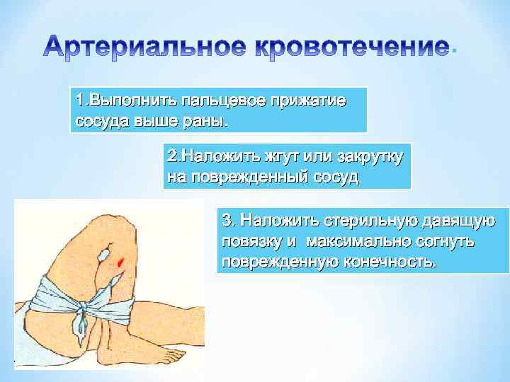 . 1. Выполнить пальцевое прижатие сосуда выше раны. 2. Наложить жгут или закрутку на