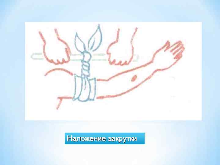 Наложение закрутки 