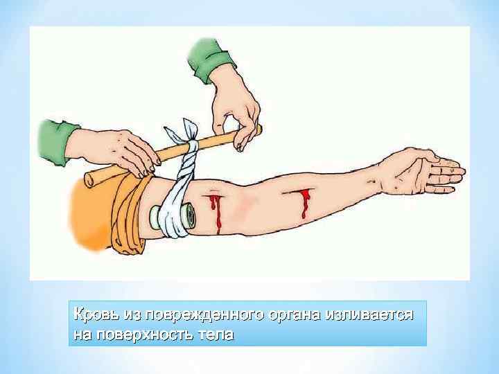 Кровь из поврежденного органа изливается на поверхность тела 