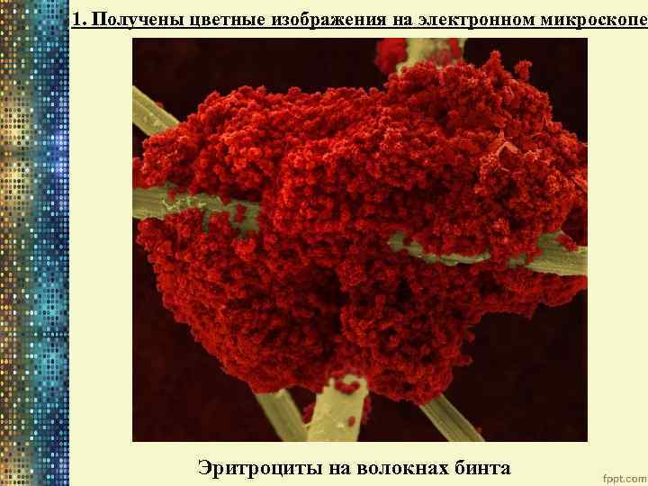1. Получены цветные изображения на электронном микроскопе Эритроциты на волокнах бинта 