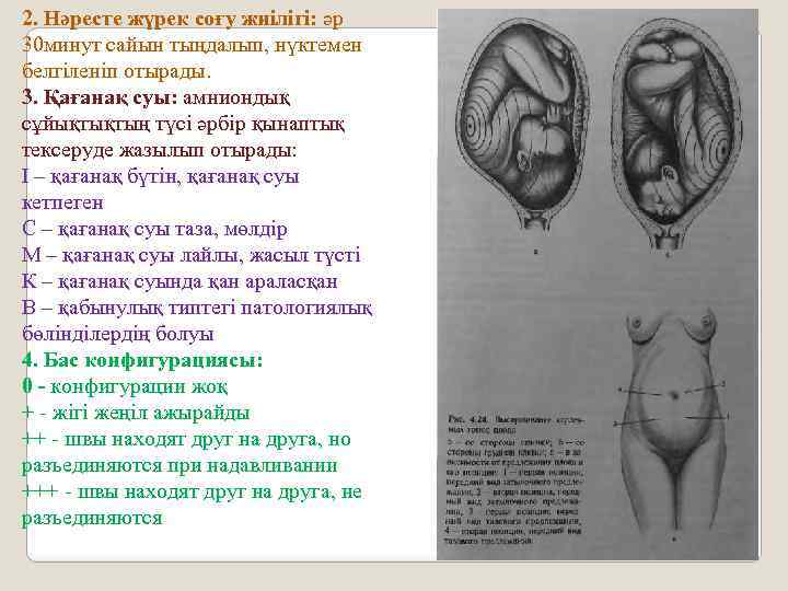 2. Нәресте жүрек соғу жиілігі: әр 30 минут сайын тыңдалып, нүктемен белгіленіп отырады. 3.