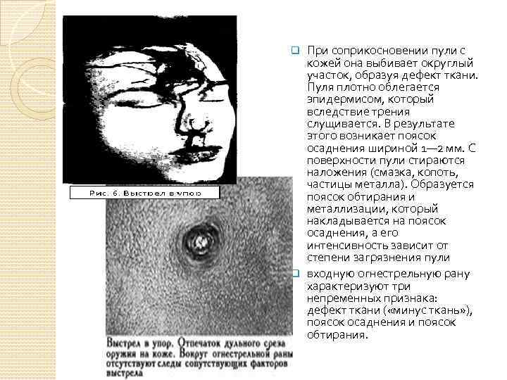 При соприкосновении пули с кожей она выбивает округлый участок, образуя дефект ткани. Пуля плотно