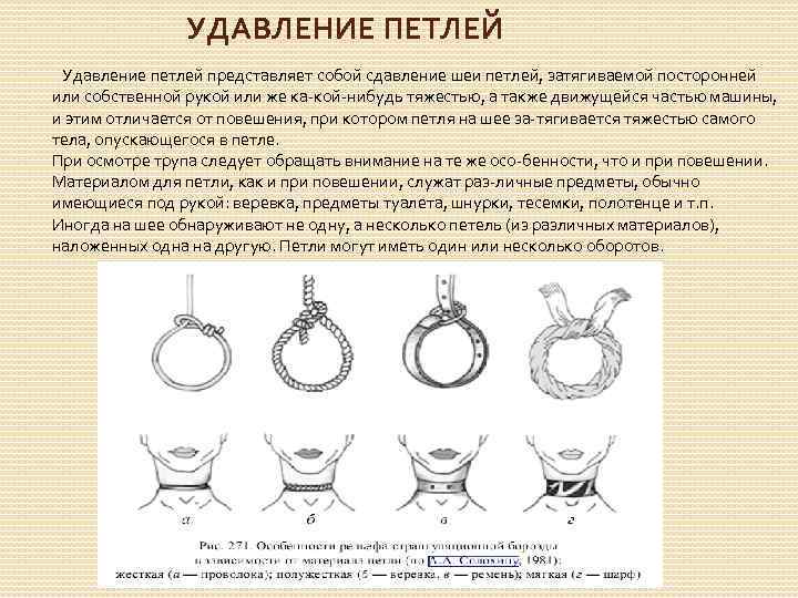УДАВЛЕНИЕ ПЕТЛЕЙ Удавление петлей представляет собой сдавление шеи петлей, затягиваемой посторонней или собственной рукой