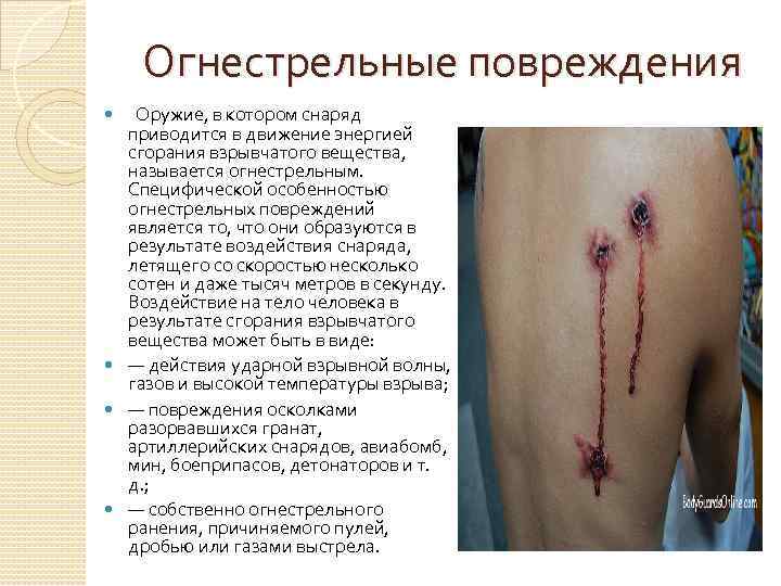 Огнестрельные повреждения Оружие, в котором снаряд приводится в движение энергией сгорания взрывчатого вещества, называется