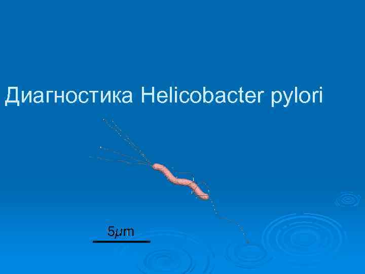 Диагностика Helicobacter pylori 