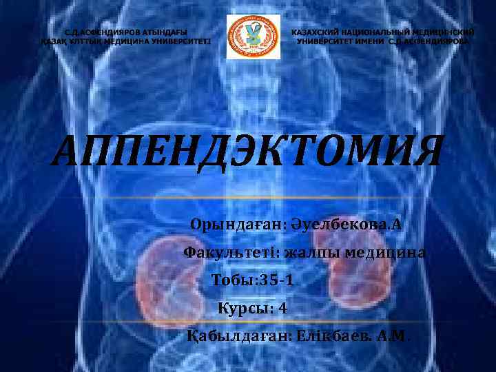 АППЕНДЭКТОМИЯ Орындаған: Әуелбекова. А Факультеті: жалпы медицина Тобы: 35 -1 Курсы: 4 Қабылдаған: Елікбаев.