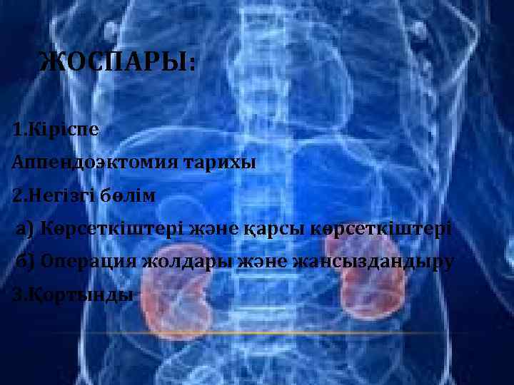 ЖОСПАРЫ: 1. Кіріспе Аппендоэктомия тарихы 2. Негізгі бөлім а) Көрсеткіштері және қарсы көрсеткіштері б)