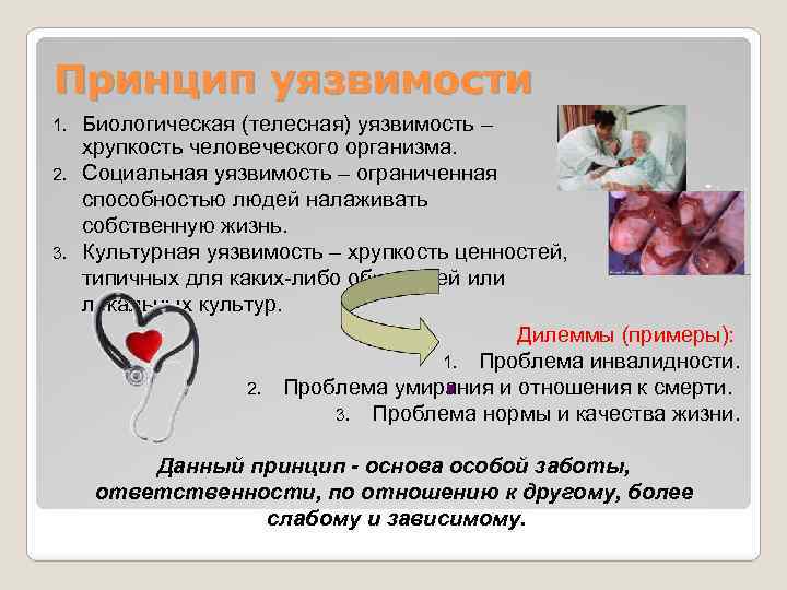 Принцип уязвимости 1. 2. 3. Биологическая (телесная) уязвимость – хрупкость человеческого организма. Социальная уязвимость